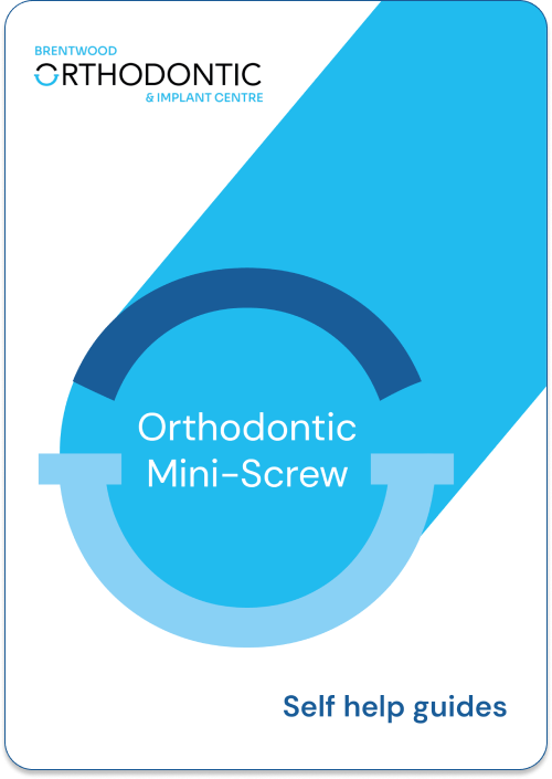 DSI ORT210 Orthodontic Mini Screw Fixture (Temporary Anchorage Device) - L10mm, Head T/m2mm, Ø1.5mm - Titanium, Made In Israel